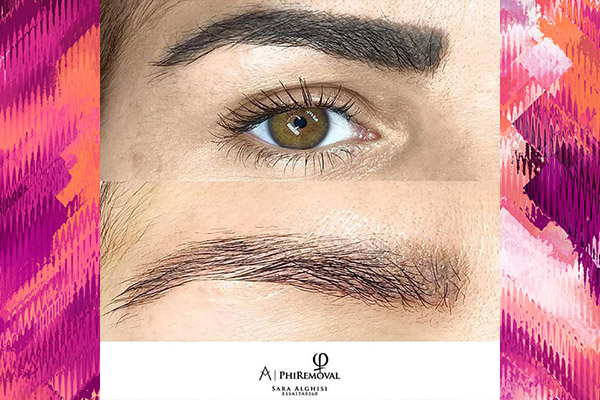 PhiRemoval - PERMANENT MAKE-UP ENTFERNUNG