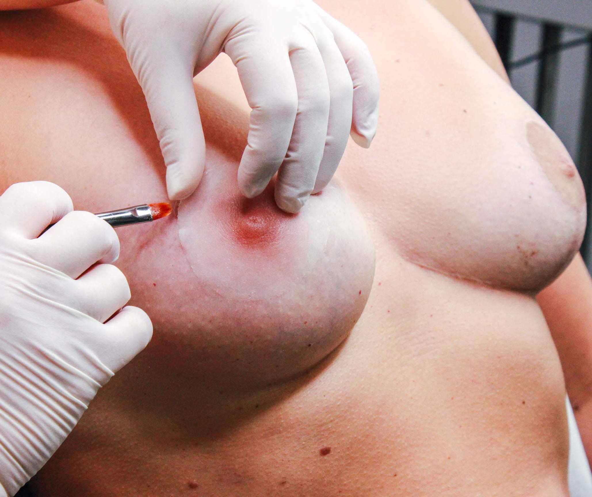 Melissa_Wefers_Oberhausen_Areola-Prothetik Melissa_Wefers_Oberhausen_Areola-Prothetik